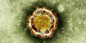 An electron microscope image of a coronavirus. Part of a family of viruses that cause ailments including the common cold and SARS,which was first identified last year in the Middle East.