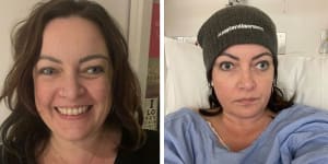Alicia Newnham,44,before and after long COVID set in.