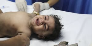 ‘Kids are traumatised’:Gaza hospitals overwhelmed with patients
