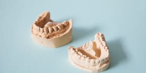 How your teeth can show if you’re stressed