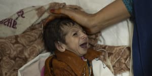 Sofia cradles her two-month-old,Abdul,as he undergoes treatment for malnutrition at a hospital in Kabul,Afghanistan,in October.