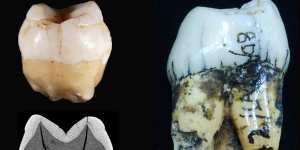 The incisor and molar discovered by Eugene Dubois in 1890.