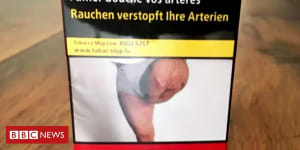 Man shocked to find his amputated leg on a cigarette packet