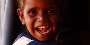 Simple treatments reduce tooth decay in remote Indigenous children