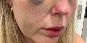 Wright was left with serious injuries after the assault.