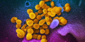 Novel coronavirus (yellow) emerges from the surface of cells in a culture grown from a patient in the United States. 