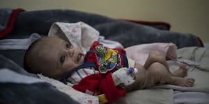 Mohammed,four months old,lies on a bed in the Indira Gandhi hospital in Kabul,Afghanistan on Monday.