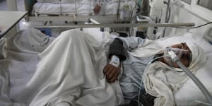 An Afghan COVID patient is treated in ICU in Kabul.