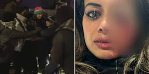 Hannah Thomas,a former Greens candidate,suffered a serious injury to her eye after police broke up a protest in Sydney’s south-west on Friday.