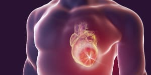 Researchers examine the link between COVID-19 and heart disease.