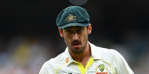 Mitchell Starc may play the second Test if he overcomes a finger injury.