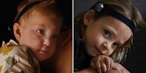 Ashton and Rowdy,from Dubbo,both require bone conduction hearing aids because of ear issues.