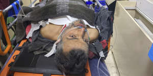 Samir Muhammed Accar after he was pulled out from a collapsed building.