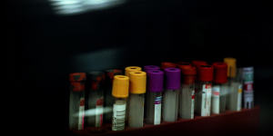 Doctors hope a DNA-based blood test will provide answers.