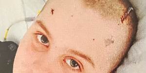 Max Shearer was just 11 years old when doctors discovered a rare form of brain cancer.