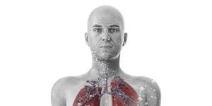 Silicosis.