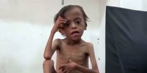 United Nations officials say Yemen will face the world's largest famine in decades if the Saudi-led coalition refuses to lift its blockade on deliveries of aid.