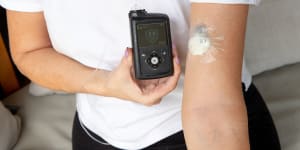 More than 90,000 Australians now use a wearable glucose monitoring device. 