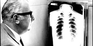 Dr. George Randmae studies a chest x-ray looking for signs of T.B.