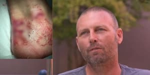 Perth father describes narrow escape after being bitten by shark