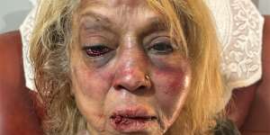 Ninette Simons was savagely assaulted in her home.