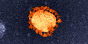 An electron-microscope image of the COVID-19 virus,isolated from the first Australian coronavirus case. Note the bubble in the centre surrounded by spikes.