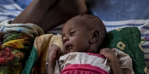 Only 20 days old,Tigsti already starving as famine stalks Ethiopia