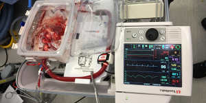 Breagha's new heart in the ex vivo perfusion rig or heart-in-a-box. 