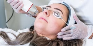 The needling triggers micro-trauma in the skin,stimulating new collagen and elastin,while the heat generated by the radio frequency tightens it.