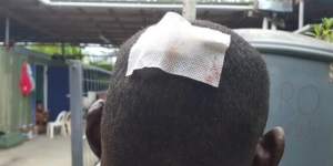 A Sudanese refugee received stitches after being hit by rock.
