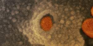 A microscope image shows the Novel Coronavirus SARS-CoV-2,orange,in February 2020 emerging from the surface of cells,gray,cultured in the lab.