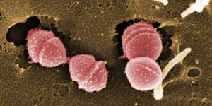 Because it is a bacteria,Strep A (pictured) can be treated with antibiotics,but there is not currently a vaccine against it.