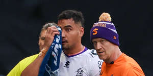 Eliesa Katoa with a Storm trainer after copping friendly fire from Christian Welch against Cronulla.