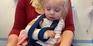 Delilah Lewis with her broken arm in 2023.