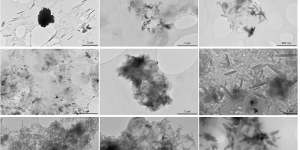 Shards of microplastic captured in kidney,liver and brain samples.