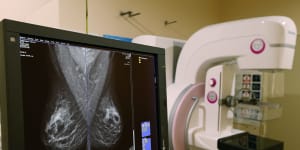 Study finds Google system could improve breast cancer detection