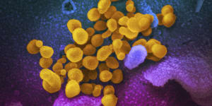 This undated,colourised electron microscope image shows the Coronavirus SARS-CoV-2.
