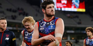 Angus Brayshaw was forced into a premature retirement.