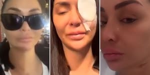 Sydney TikTok personality Jenny Elhassan was the victim of an alleged acid attack on Friday night. 