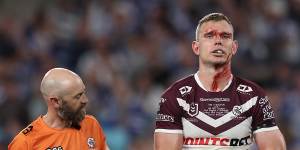 ‘I’ve never seen someone as resilient as Tommy’:Manly great in awe of Trbojevic’s mental toughness