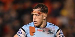 A bleed apart:Why even 300 stitches can’t stop Cronulla’s hard man