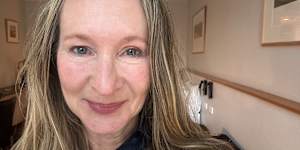 Kate Halfpenny re-succumbed to Botox before a big birthday.