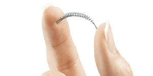 A key issue emerging in the case is whether the Essure device caused long-term inflammation.