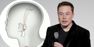 Elon Musk is making big promises about his medical start-up.