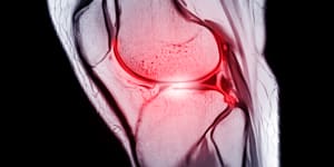 They’re three letters athletes dread. What is a ruptured ACL and how do you fix it?