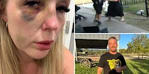 Chloe Wright was assaulted by her ex-partner,who has since been granted bail as he awaits sentencing.