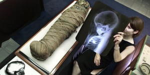 Mummified body parts to be removed from Sydney museum amid intense global debate