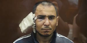 Saidakrami Murodali Rachabalizoda,a suspect in the Crocus City Hall shooting,with facial injuries and a large bandage on his ear. 