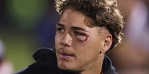 Reece Walsh fractured an eye socket against the Panthers in March.