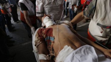A Palestinian man wounded in the attack.